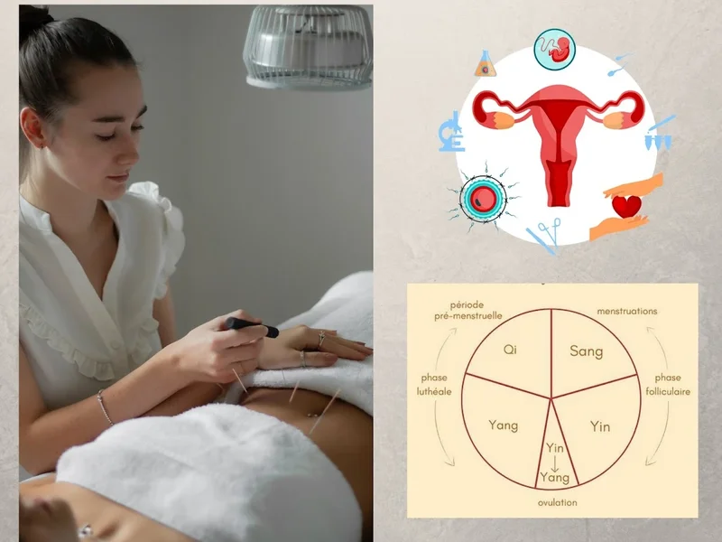 Marianne Gravel Acupuncteure à L' Ancienne-Lorette | Acupuncture Clinique Nadeau