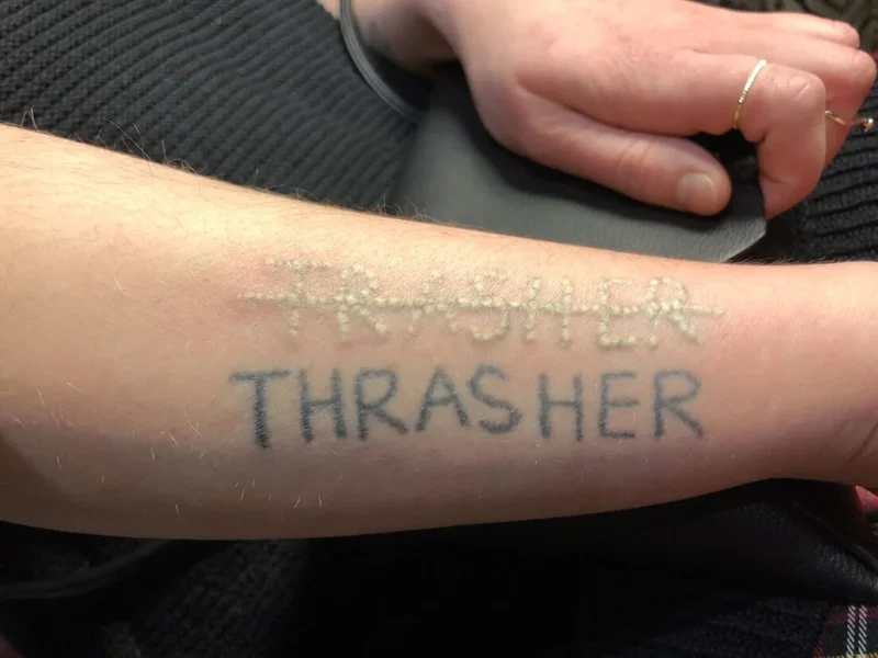 Clinique de Detatouage Laser Québec - Depuis 5 ans - 100% satisfaction