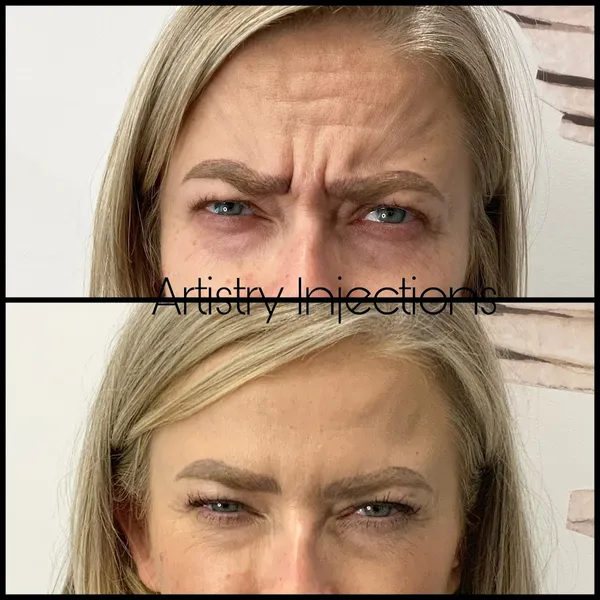 Artistry Injections