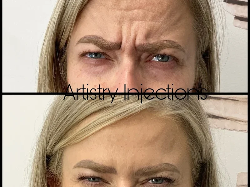 Artistry Injections