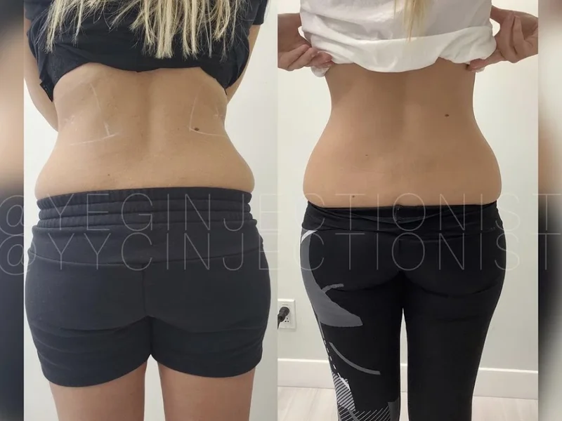 The Injectionist & Aesthetics