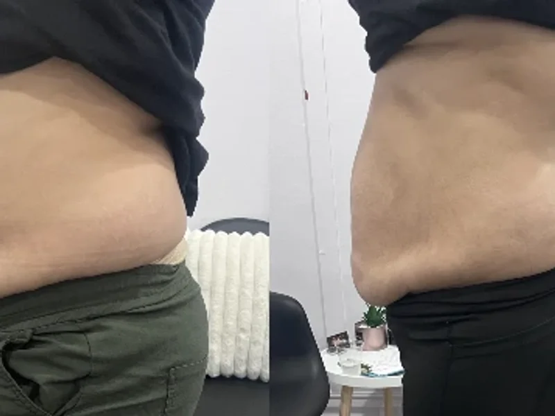 True Curves Body contouring and Medical Spa