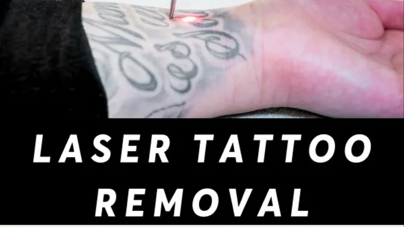 Ex Inked Laser Tattoo And Permanent Makeup Removal