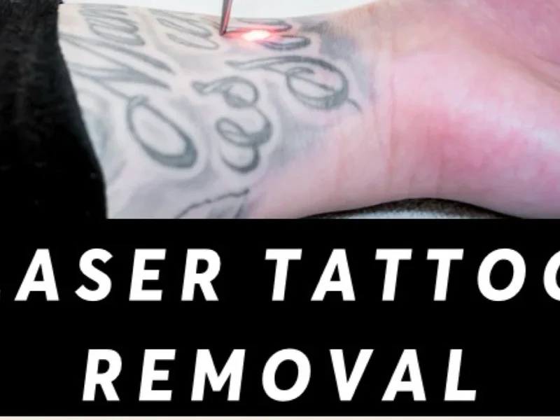 Ex Inked Laser Tattoo And Permanent Makeup Removal