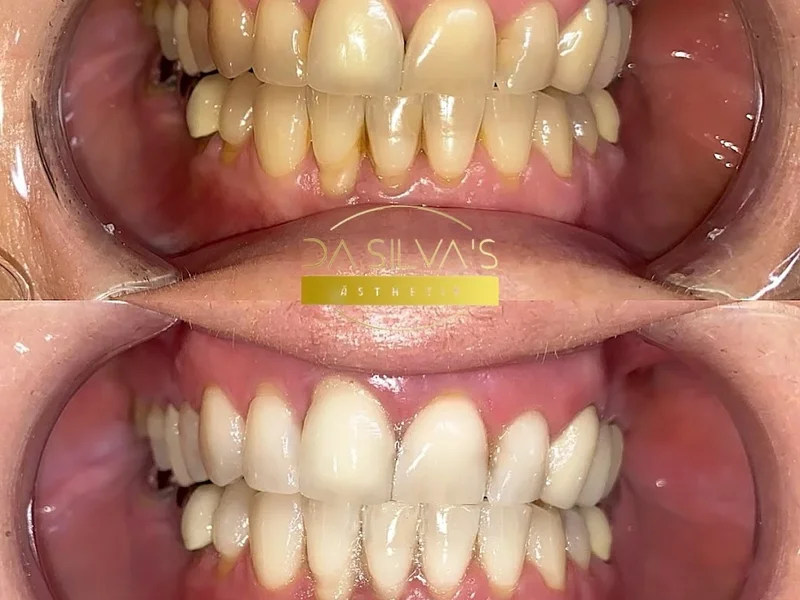 Da Silva‘s Ästhetik