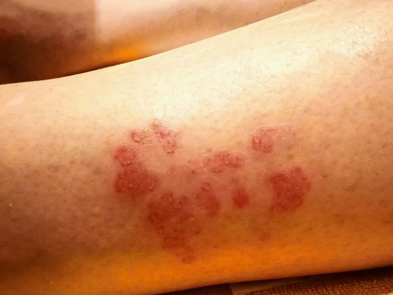 SCHÖNHEIT PUR MUNICH