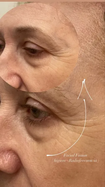 Leicy Esthetic Beauty Center