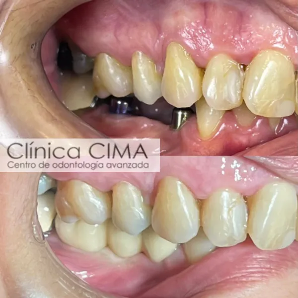 Clínica CIMA Implantología | Centro de Odontologia Avanzada