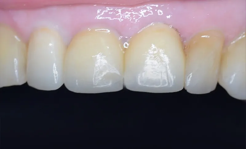 Dentin Odontólogos (Clínica Dental)