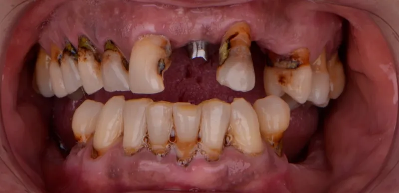 Clínica Dental De Sousa Santacoloma | Chamberí
