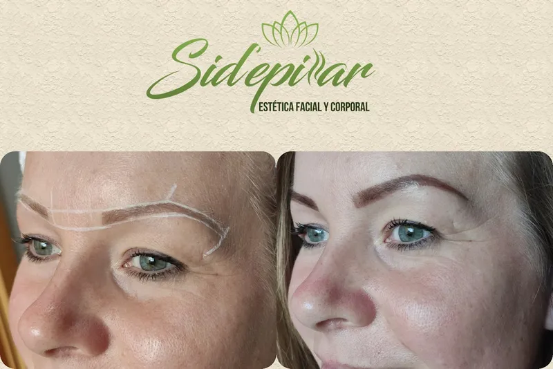 Sidepilar y Estetica