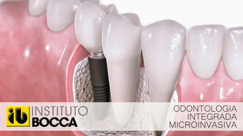 Clínica Dental Instituto Bocca