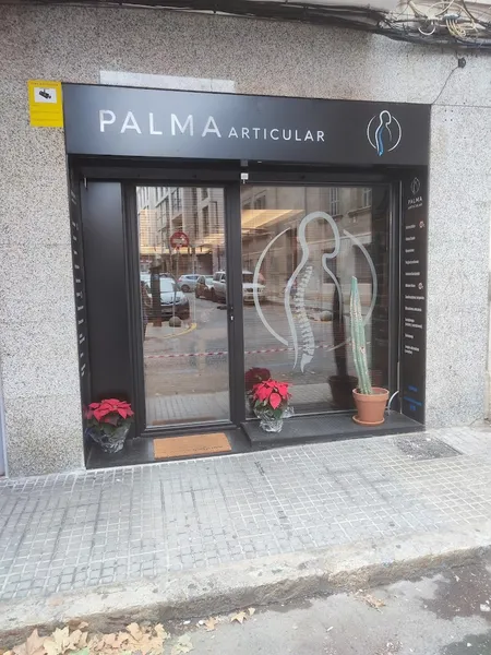 Palma Articular