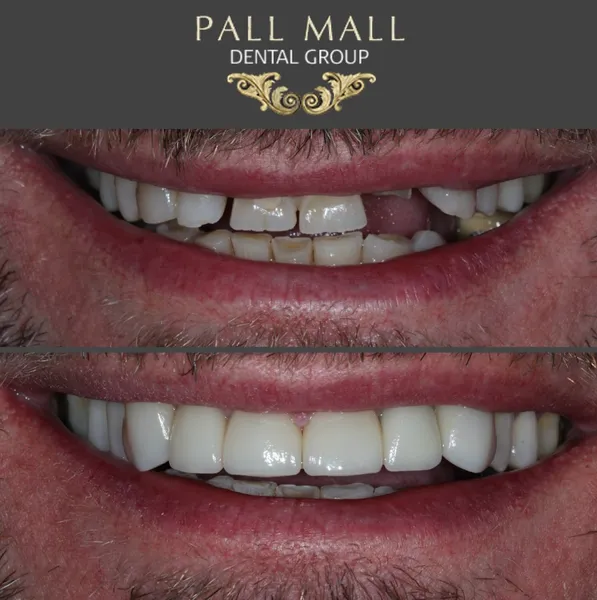 Pall Mall Dental London