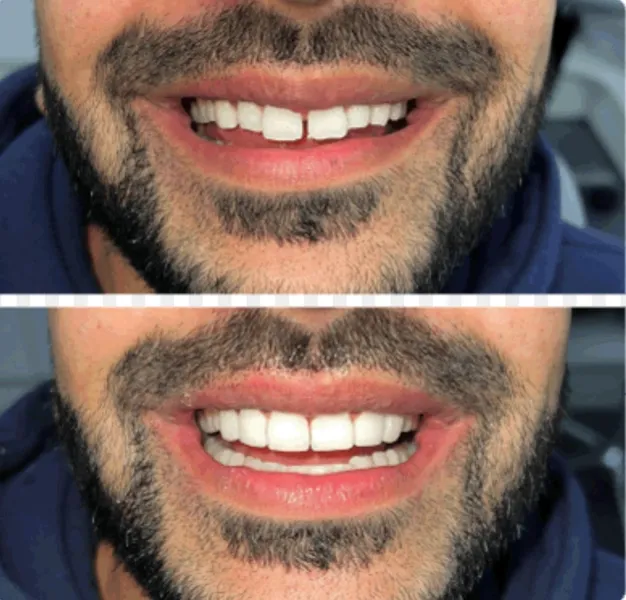 Smile Dental Clinics