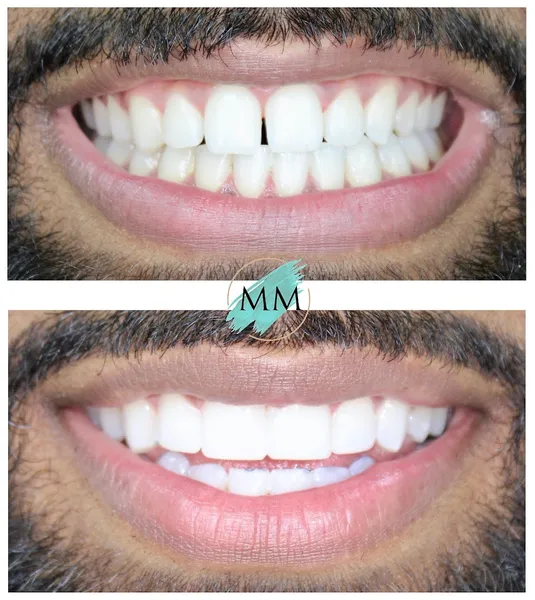 Ixia Dental- Implant & Sedation Centre (MM Dental Care Harrow)