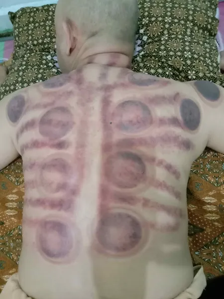 Ningsi spa massage