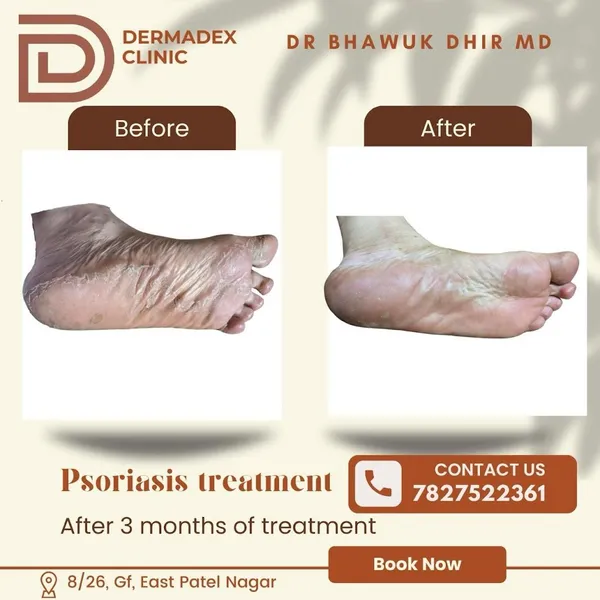 DERMADEX CLINIC - Dr Bhawuk Dhir