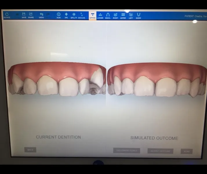 Simplismile Dental Invisalign Clinic