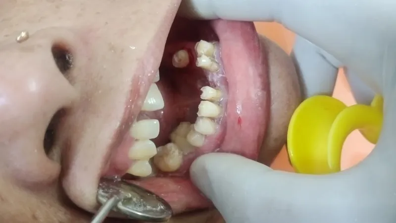 Dental Options