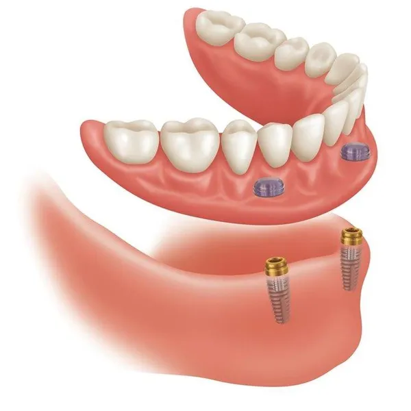 Studi dentistici di qualita'Centri Dental Roma.Gli specialisti in soluzioni protesiche.