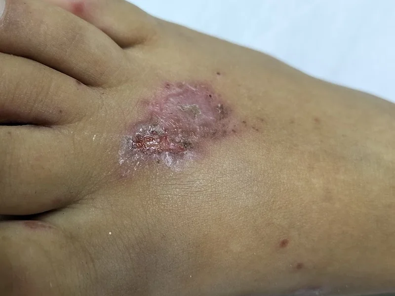 Guarnieri Dott.ssa Vincenza - Dermatologa