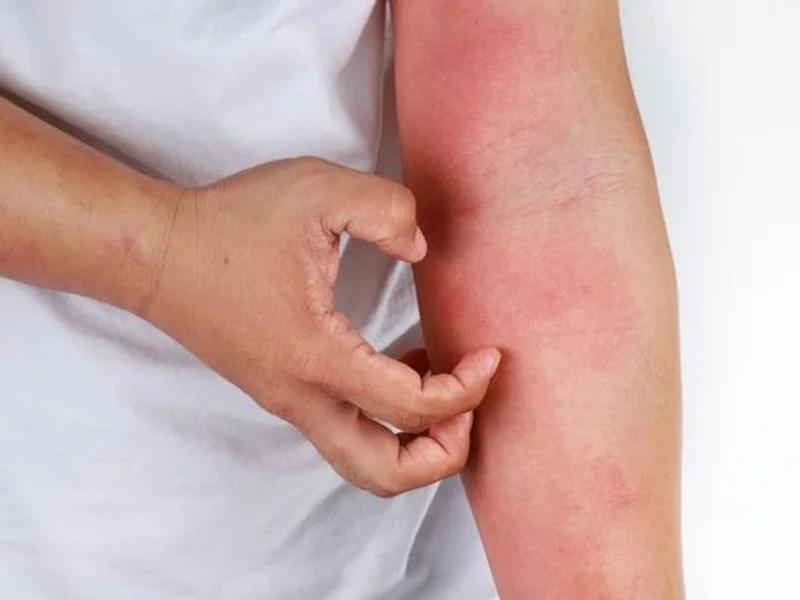 Francesco Dr. Mazzotta