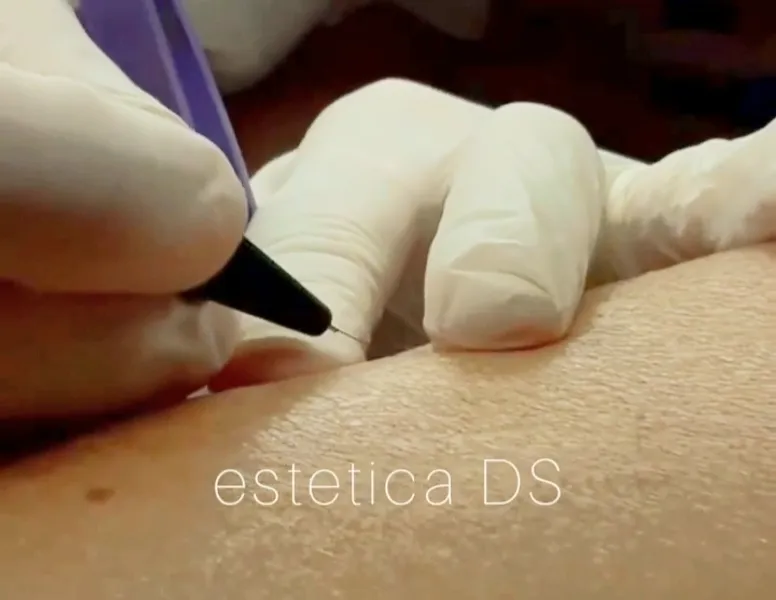 Estetica Ds