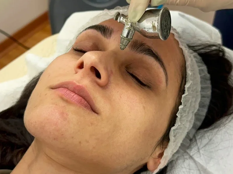 Flash Laser Tuscolano