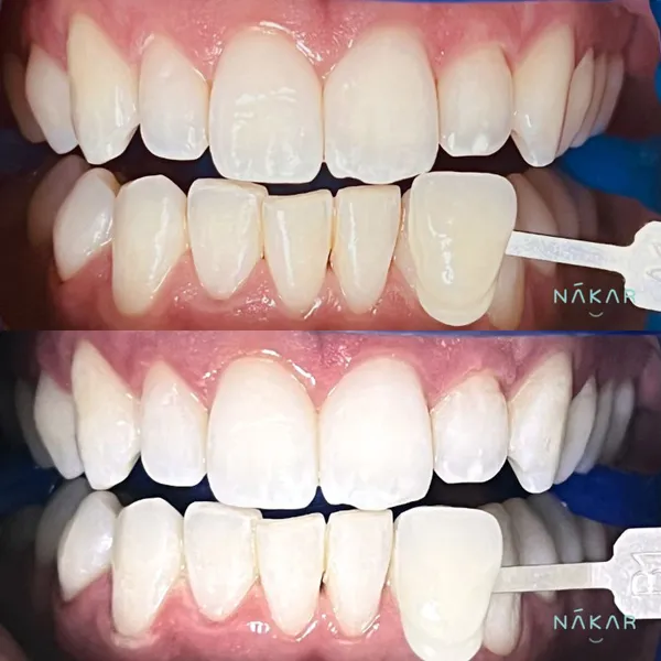 Dentista Karime Armas - Nákar Odontología Polanco CDMX