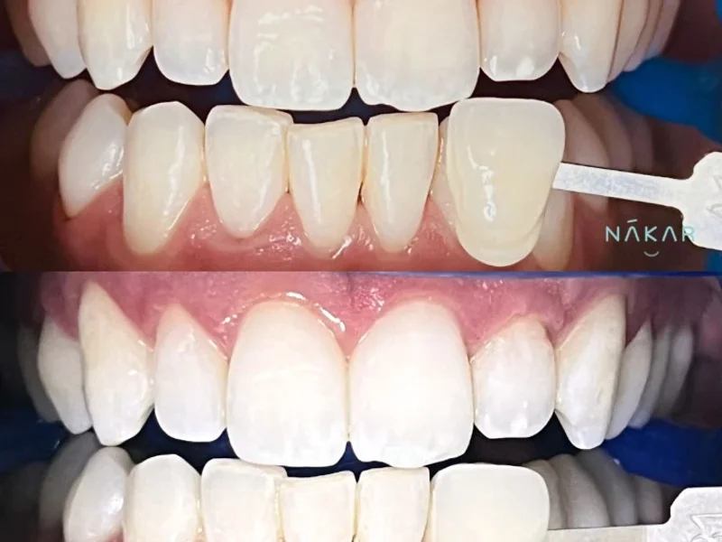 Dentista Karime Armas - Nákar Odontología Polanco CDMX