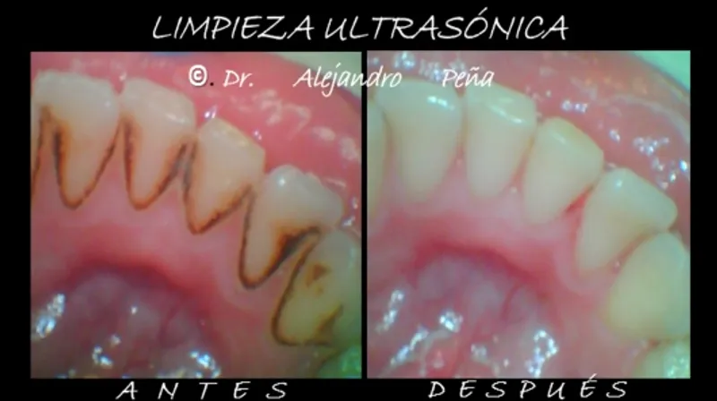 Dentista en Polanco - Dr. Alejandro Peña Vega