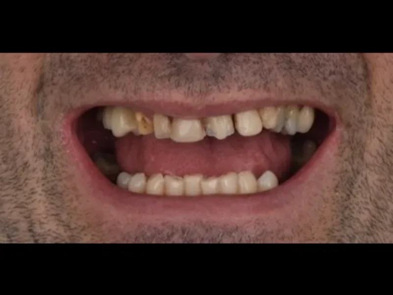 SMILE IMPLANT CENTER NAPOLES