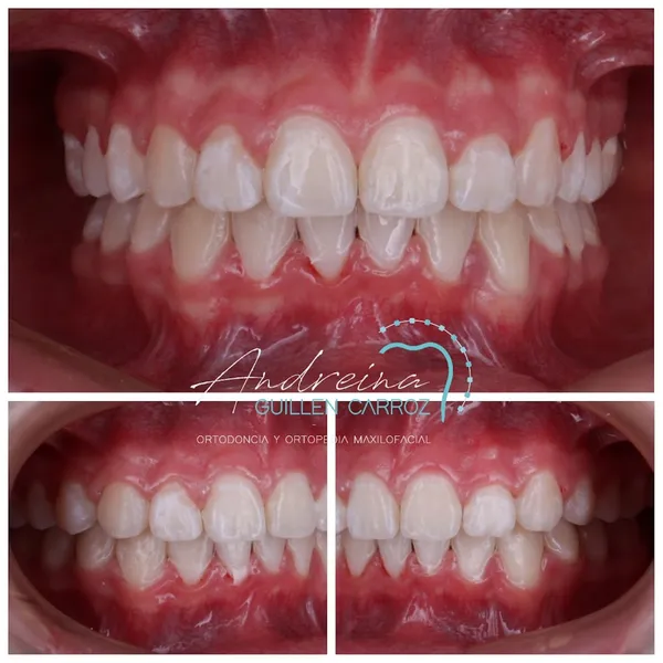 Consultorio Dental - Ortodoncia | Dra. Andreina Guillen Carroz