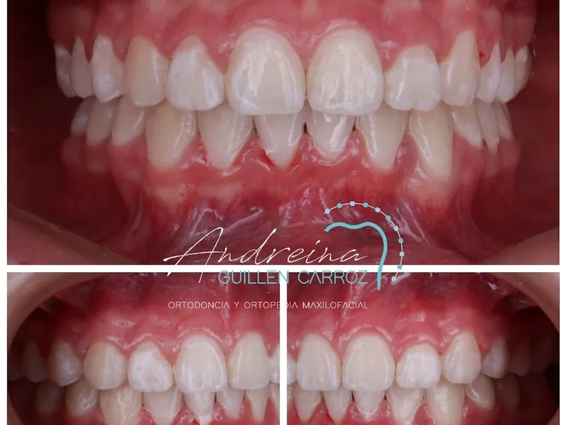Consultorio Dental - Ortodoncia | Dra. Andreina Guillen Carroz
