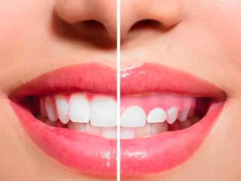 Clínica Dental Y Ortodoncia - Dentista en San Cristobal, Ecatepec. Dra. Erika Méndez Hernandez