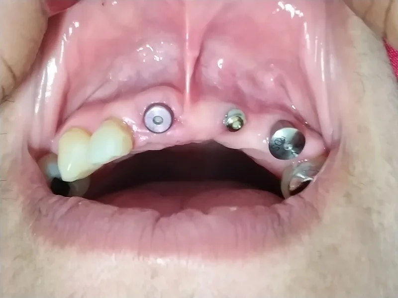 Odontología y Ortodoncia - Ojo de Agua