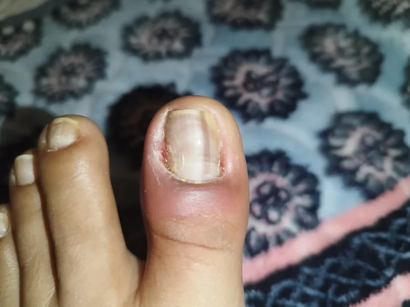 Podologia para Todos