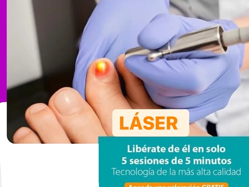 Podología Zumpango Spa footconfort