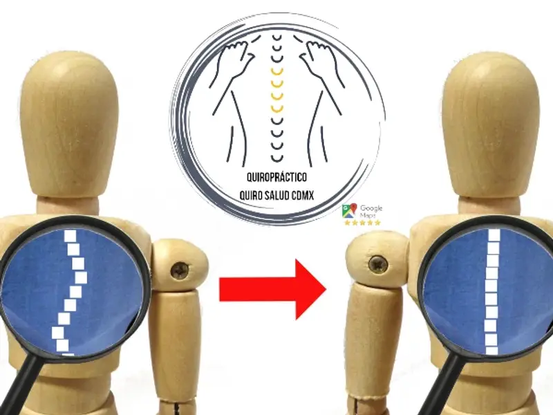Quiropráctico Quiro Salud Cdmx
