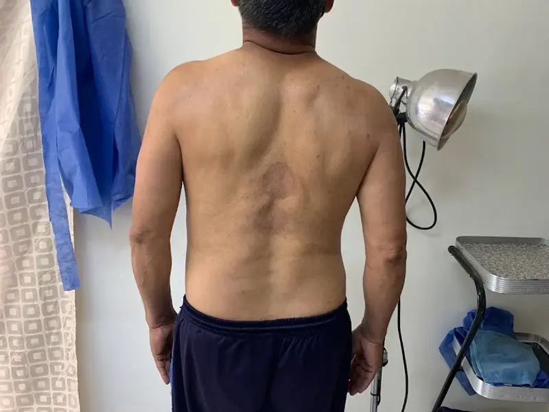 Quiropractico María Elena