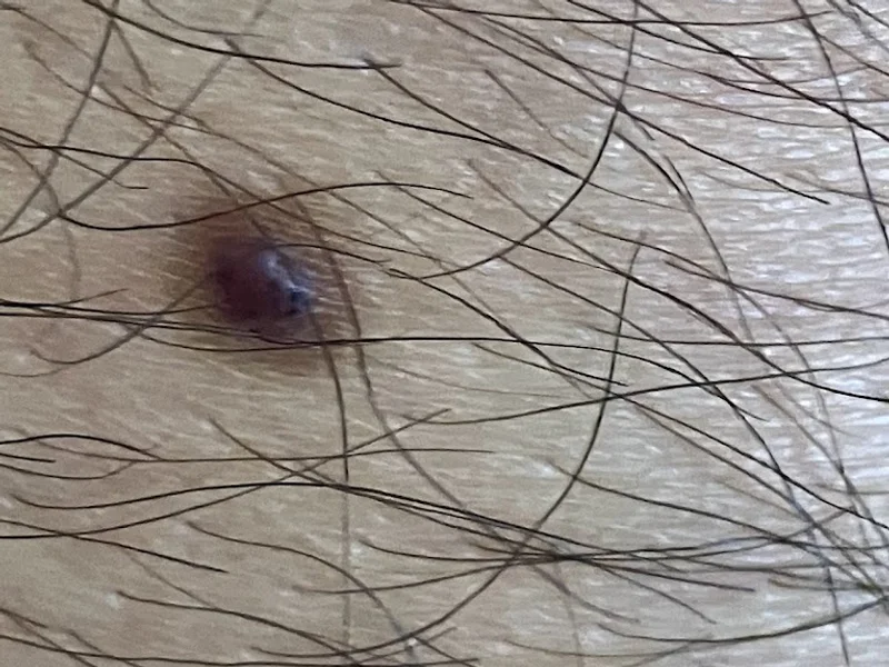 Dermatología Pediátrica y Pediatría