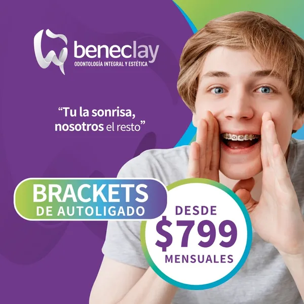 BENECLay TECAMAC ORTODONCIA Y ODONTOLOGÍA INTEGRAL