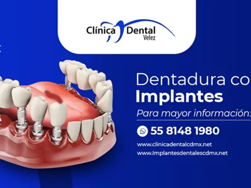Clinica Dental VELEZ CDMX
