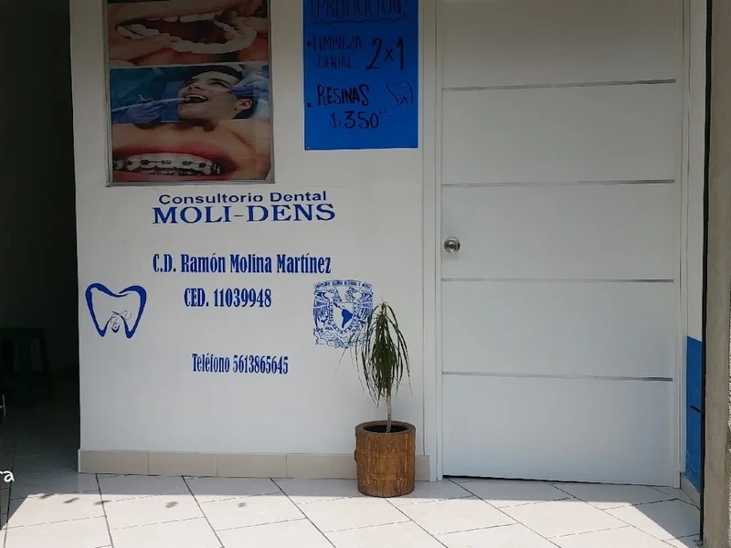 Consultorio dental moli-dens chalco