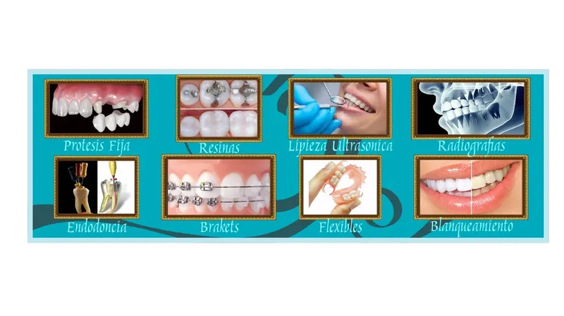 Clínica dental chalco