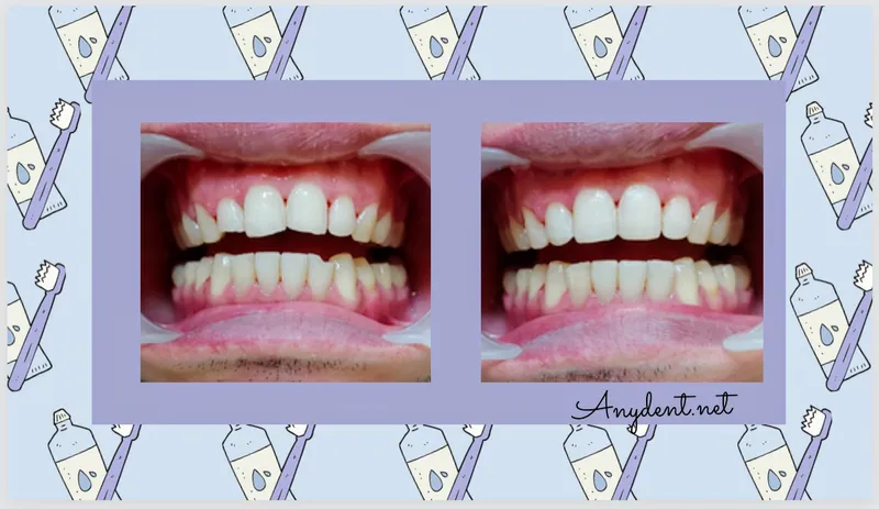 Anydent Cuidando tu sonrisa