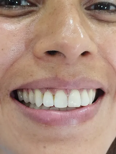 Punto Dental – Dentista en Ciudad Satélite