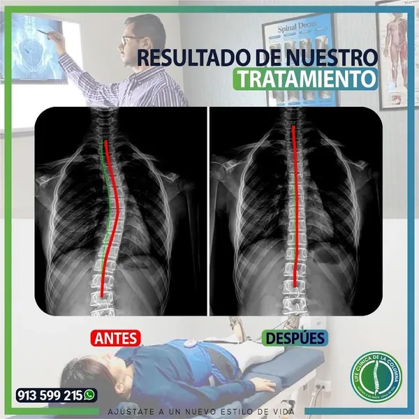 LIFE CLINICA DE LA COLUMNA