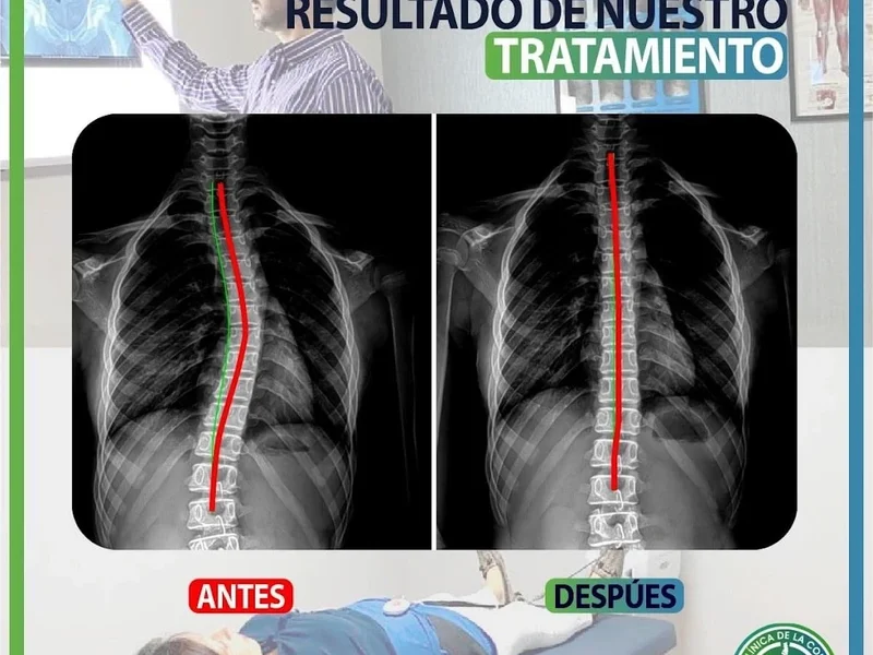 LIFE CLINICA DE LA COLUMNA